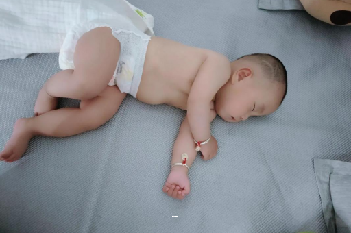 双峰孕妇前庭大腺囊肿